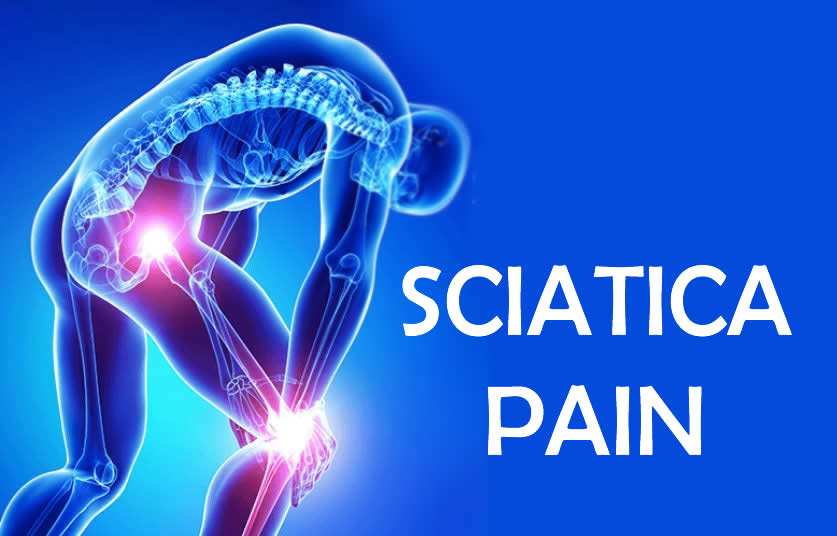 Read more about the article Sciatica Pain