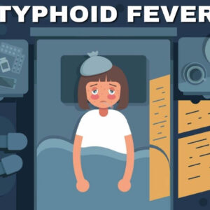 Read more about the article TYPHOID FEVER