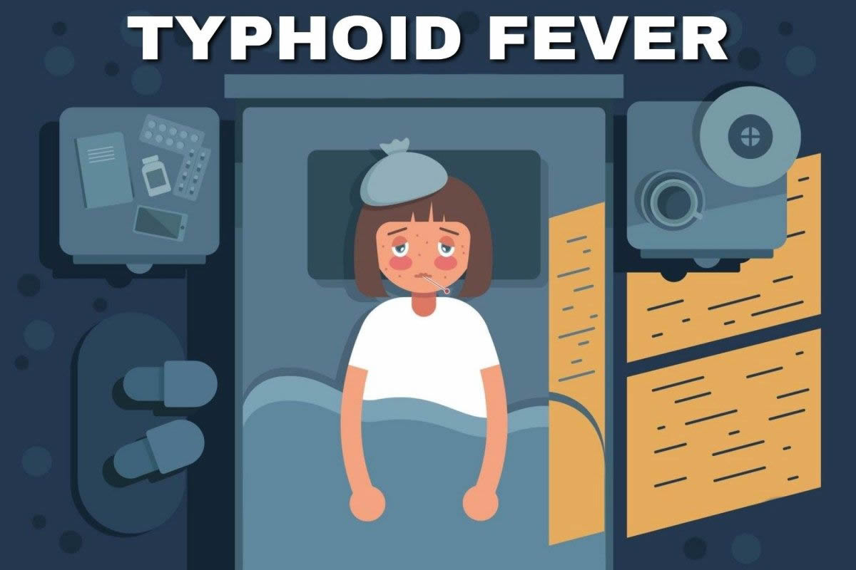 You are currently viewing TYPHOID FEVER